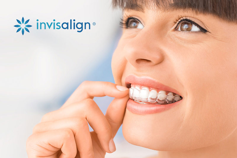 Dental Treatments in Coronado