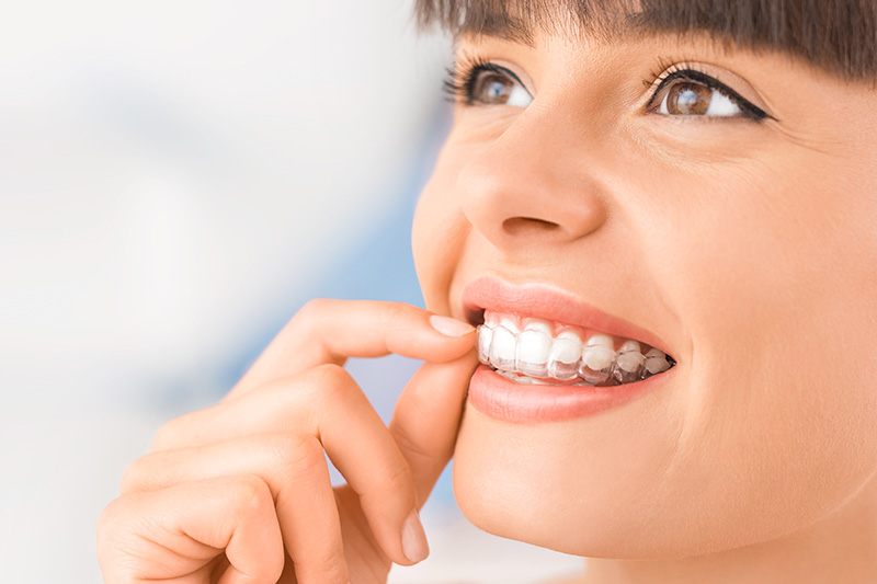 Invisalign in Coronado